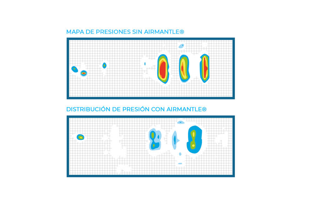 Protección de la piel y confort: Airmantle®