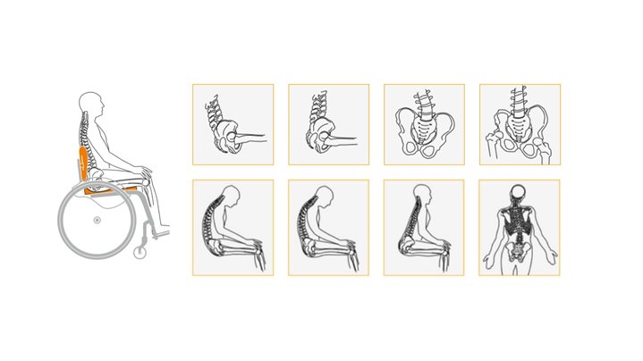 Las diferentes posturas de la pelvis y la columna vertebral en sedestación