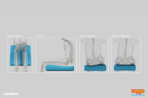 Mygo 2 - Pelvic support